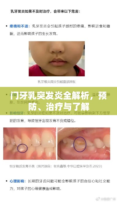 门牙乳突发炎全解析,预防、治疗与了解