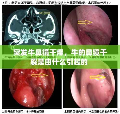 突发牛鼻镜干燥,牛的鼻镜干裂是由什么引起的
