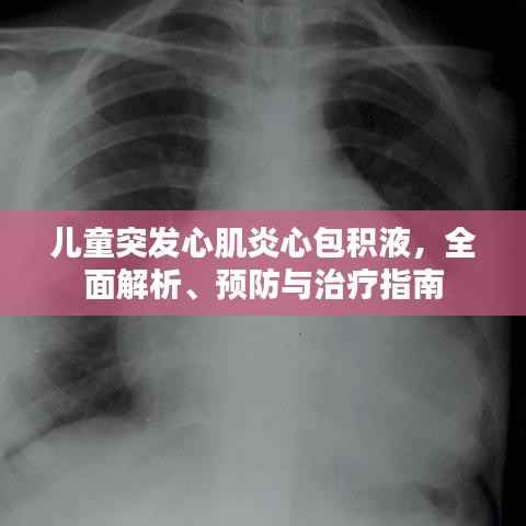 儿童突发心肌炎心包积液,全面解析、预防与治疗指南