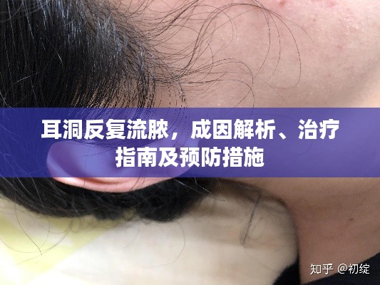 耳洞反复流脓,成因解析、治疗指南及预防措施
